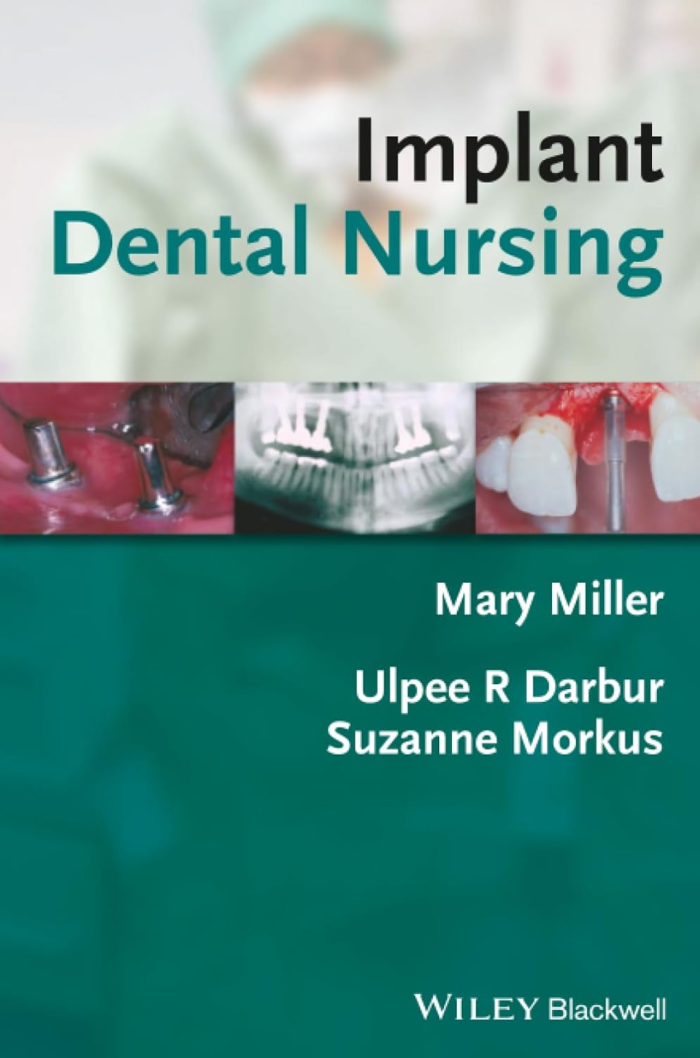 Implant Dental Nursing