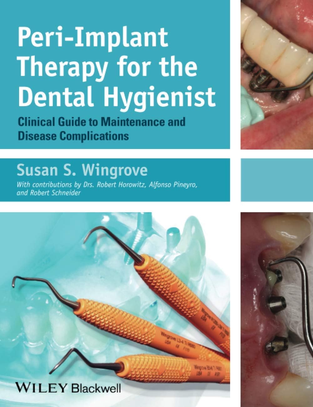 Peri-Implant Therapy for the Dental Hygienist